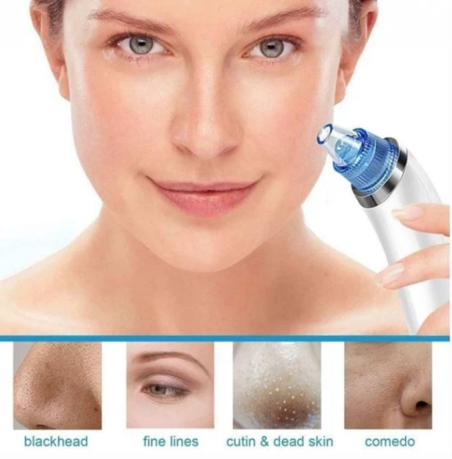 Blackhead DermaSuction για τον Καθαρισμό του Προσώπου από τα Μαύρα Στίγματα