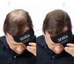 Χτενάκι Sevich Keratin Fiber Optimizer