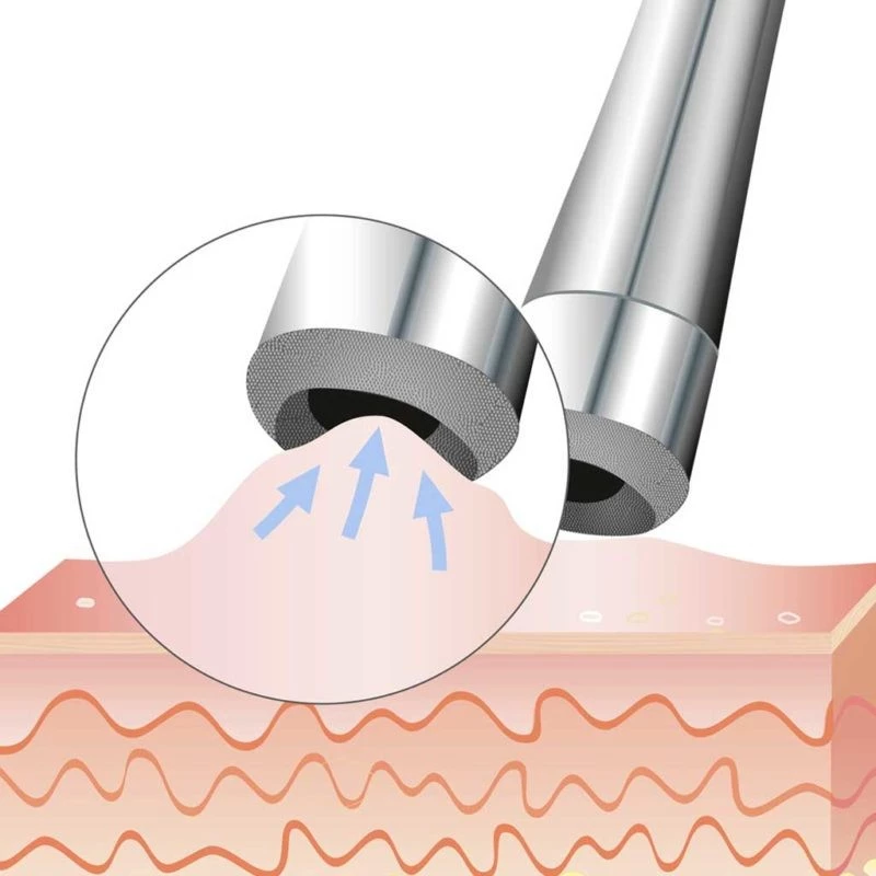 Beurer - FC 100 Pureo Derma Peel Microdermabrasion / Beauty