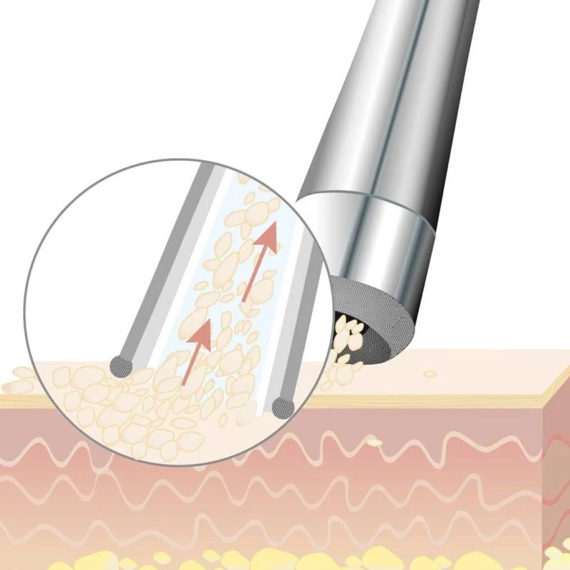 Beurer - FC 100 Pureo Derma Peel Microdermabrasion / Beauty