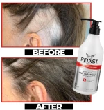 ΣΑΜΠΟΥΑΝ ΚΑΤΑ ΤΗΣ ΤΡΙΧΟΠΤΩΣΗΣ REDIST HAIRLOSS 500ml