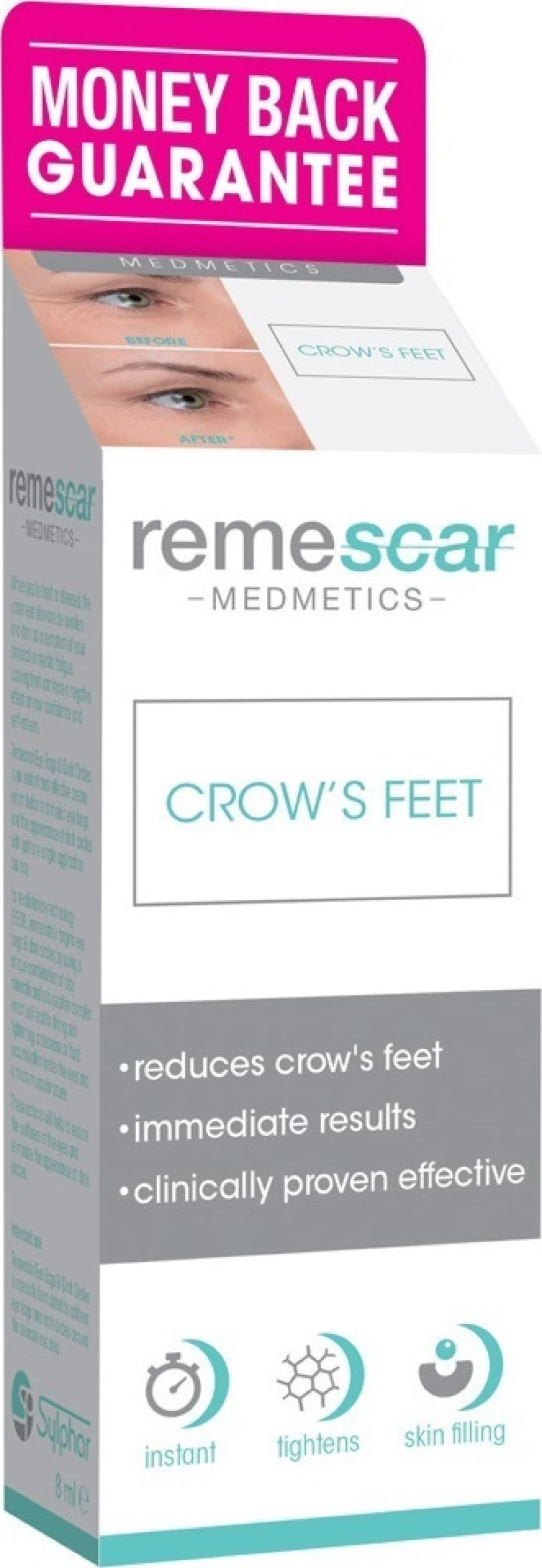 Remescar Crow’s Feet 8ml