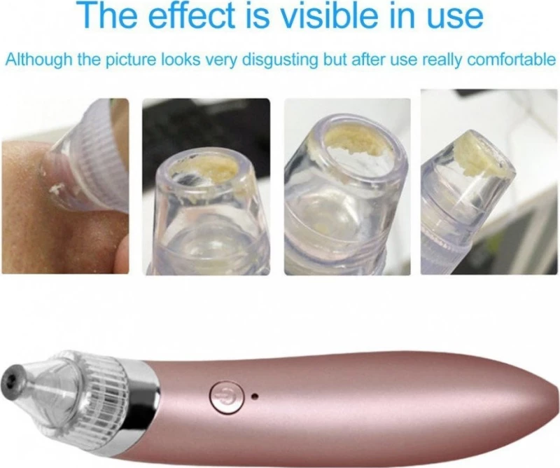 Blackhead Spot Cleaner Professional JB8620