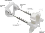 Jes Extender Titanium - Penis Enlarger