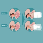 Suavinex Zero Zero 0m+ 180ml