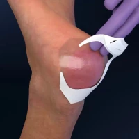 3M Tegaderm 15cm x 20cm 1τμχ