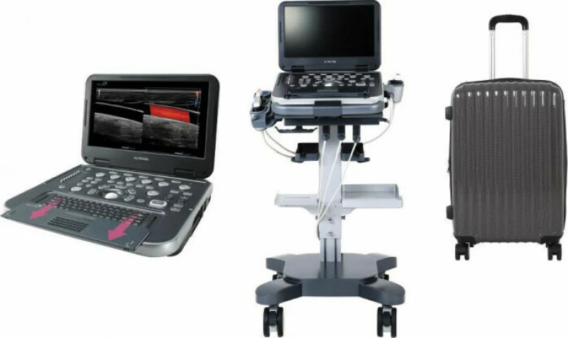 Alpinion E-Cube i7 Doppler Αγγείων