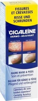Cicaleine Για Ξηρές Και Ανοιγμένες Φτέρνες Hand And Finger Cracks 50ml